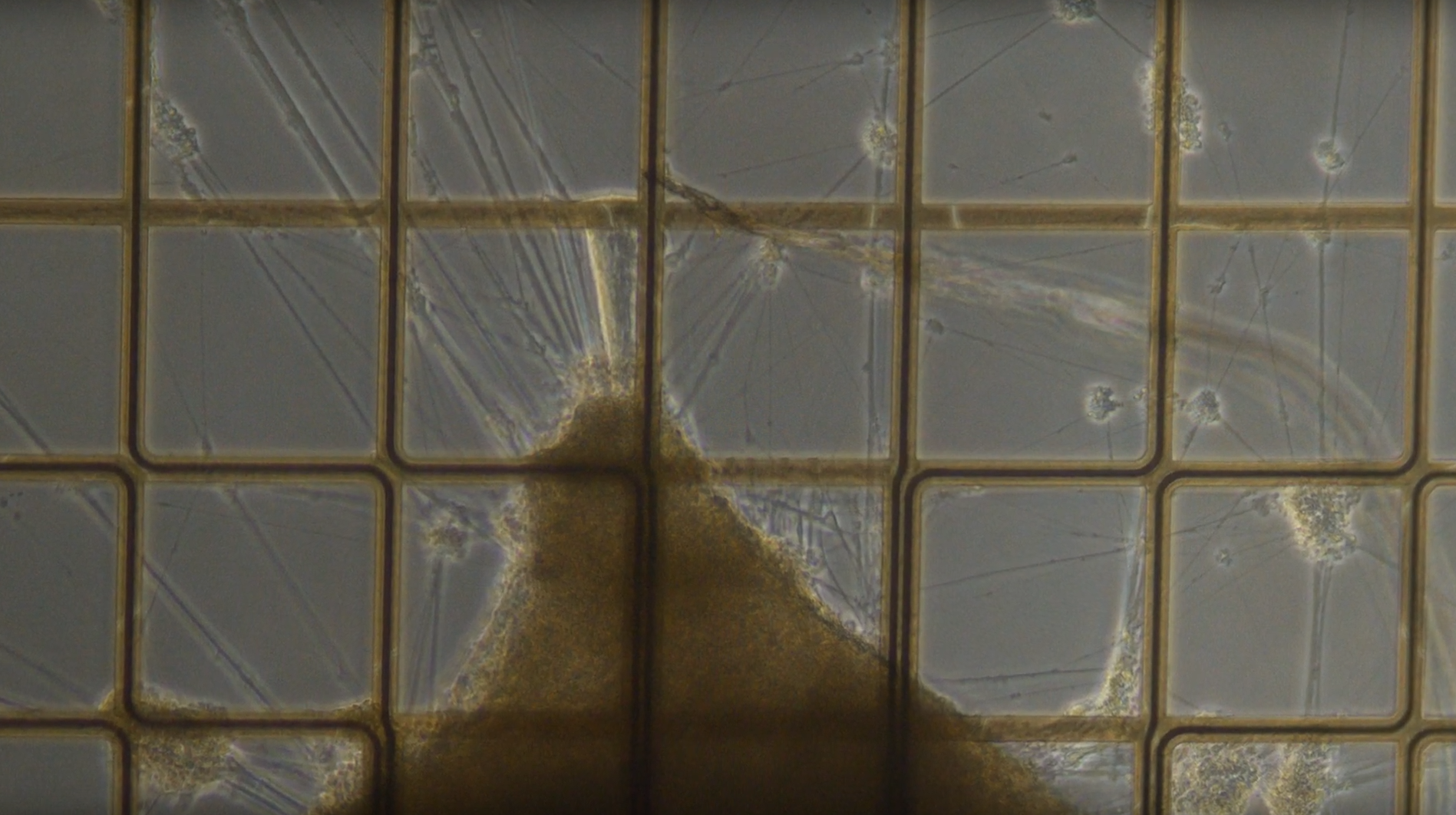Brain Organoid on a mesh of electrodes.