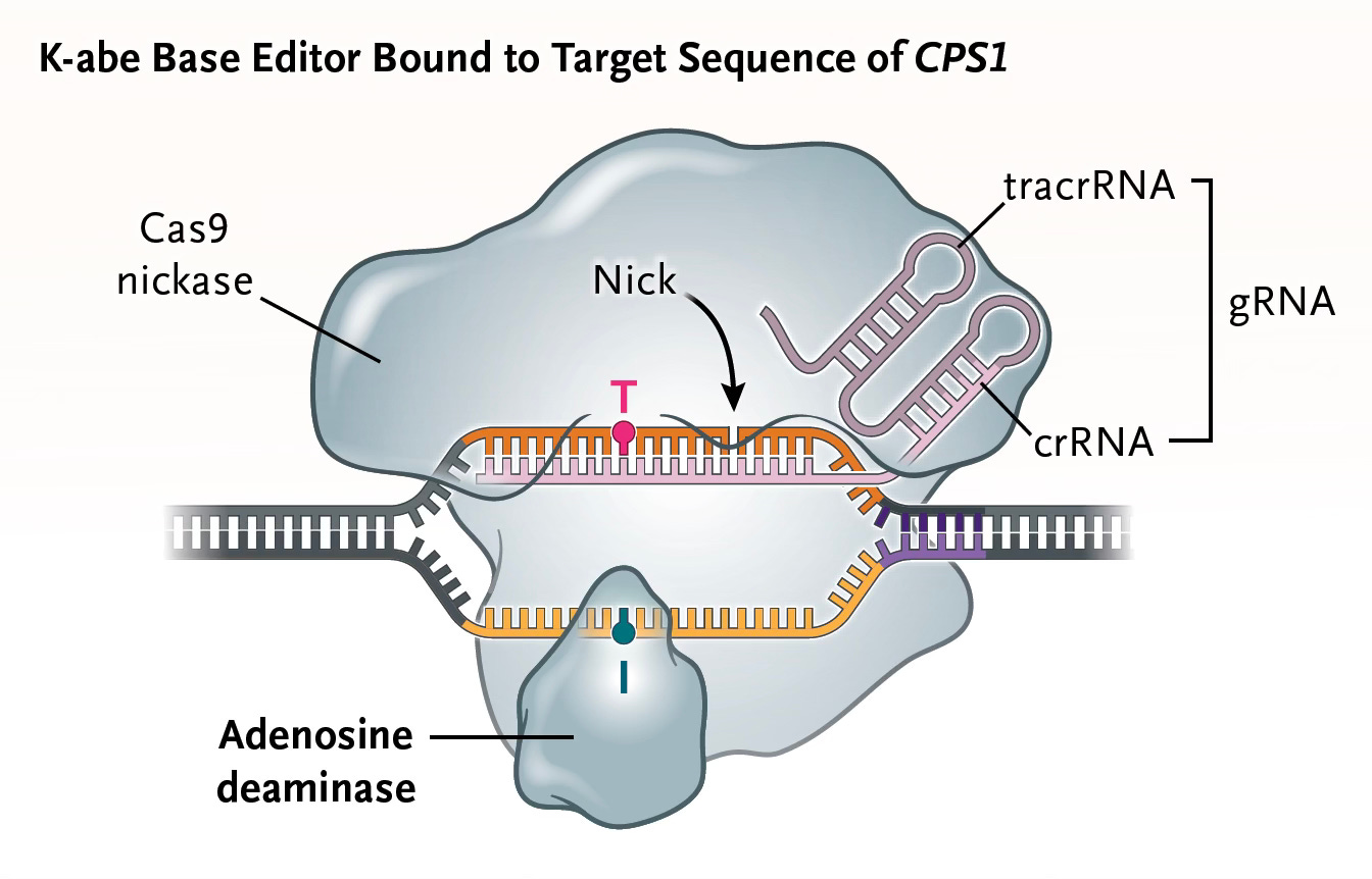 K-abe base editor bound to target sequence of CPS1 (Credit: Gropman et al. NEJM, 2025)