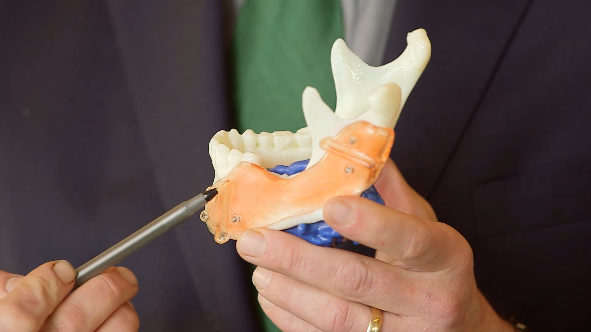 3D printed jaw with fake muscle attached