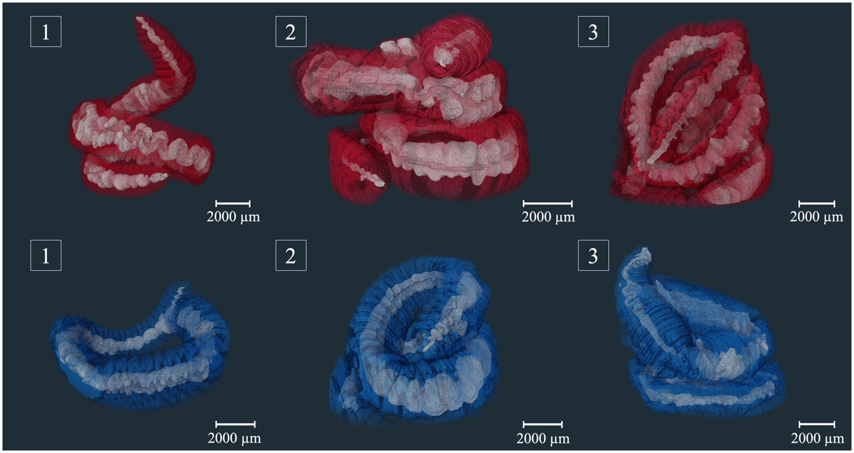 3D reconstruction of x-rayed worms. X-ray absorbing particles in the guts are shown in white.